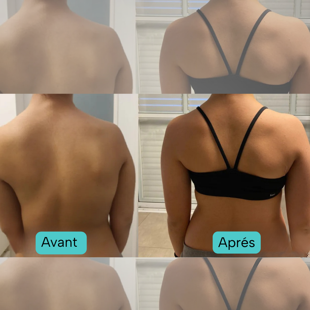 Correcteur de Posture Intelligent – Postura Paris