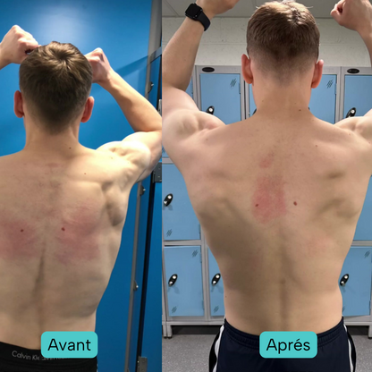 Correcteur de Posture Intelligent – Postura Paris