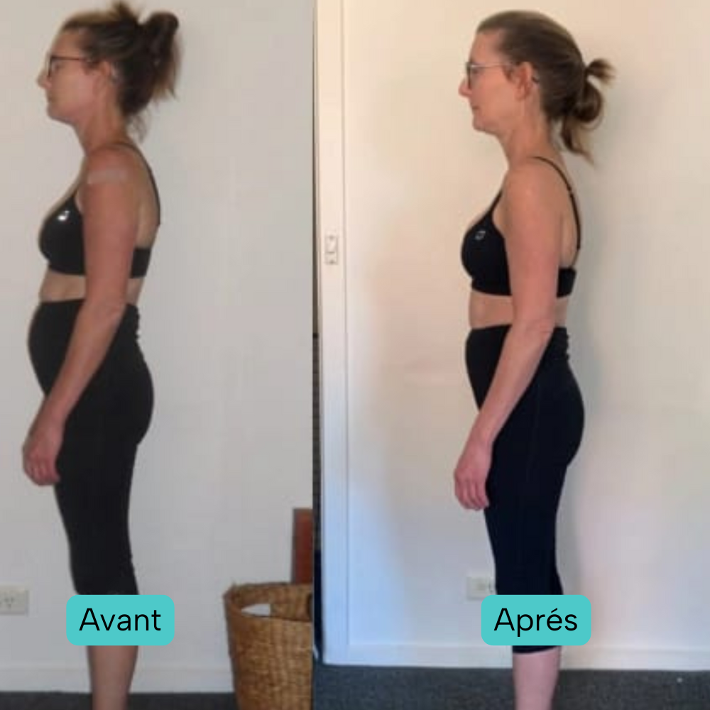 Correcteur de Posture Intelligent – Postura Paris